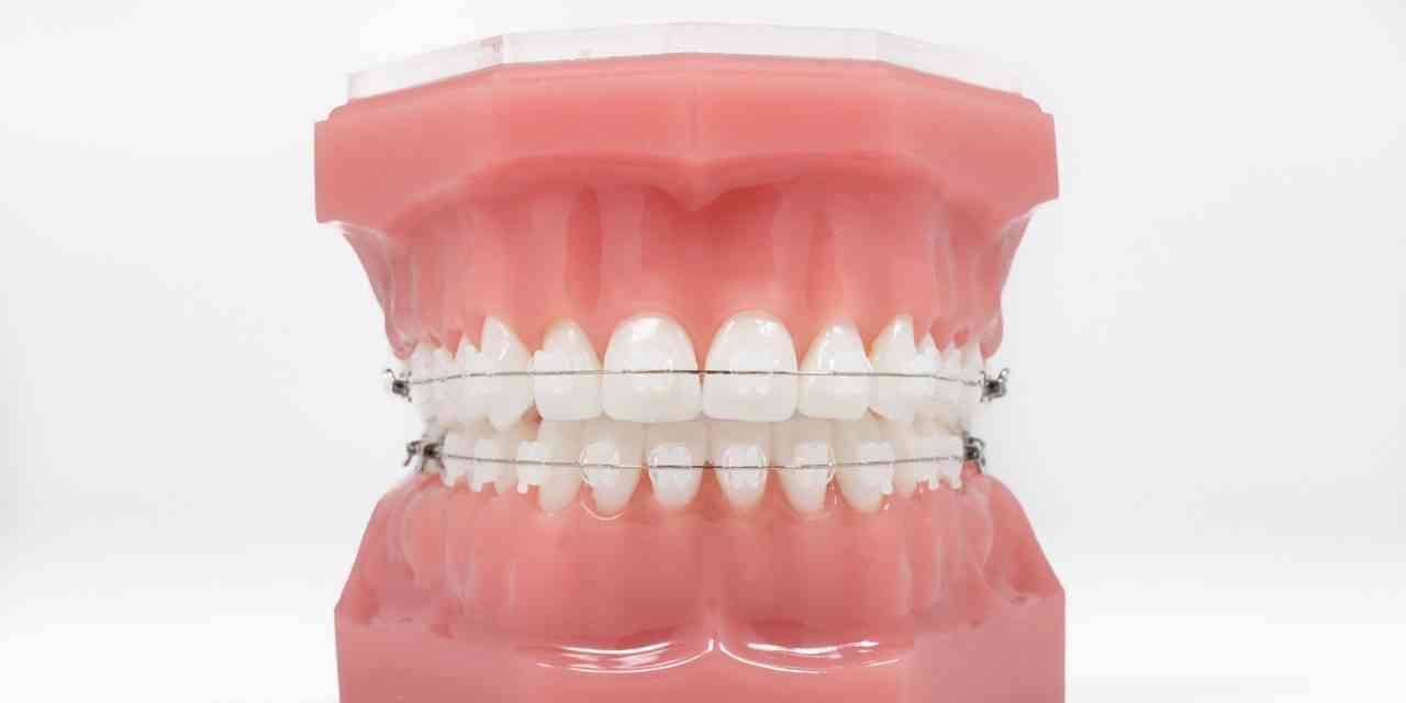 Straight Wire Braces are Creating Lifetime Memories - Westover Family Dental